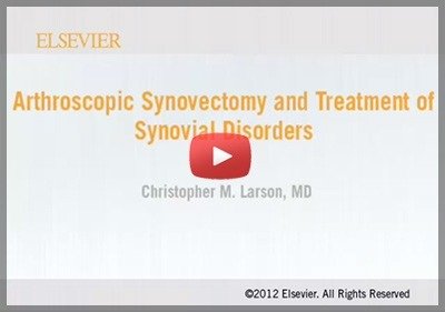 Arthroscopic Synovectomy